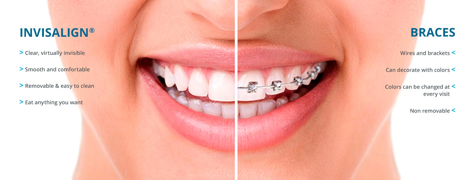 https://dental.harbors.in/wp-content/uploads/2023/04/invisalignvsbraces.jpg