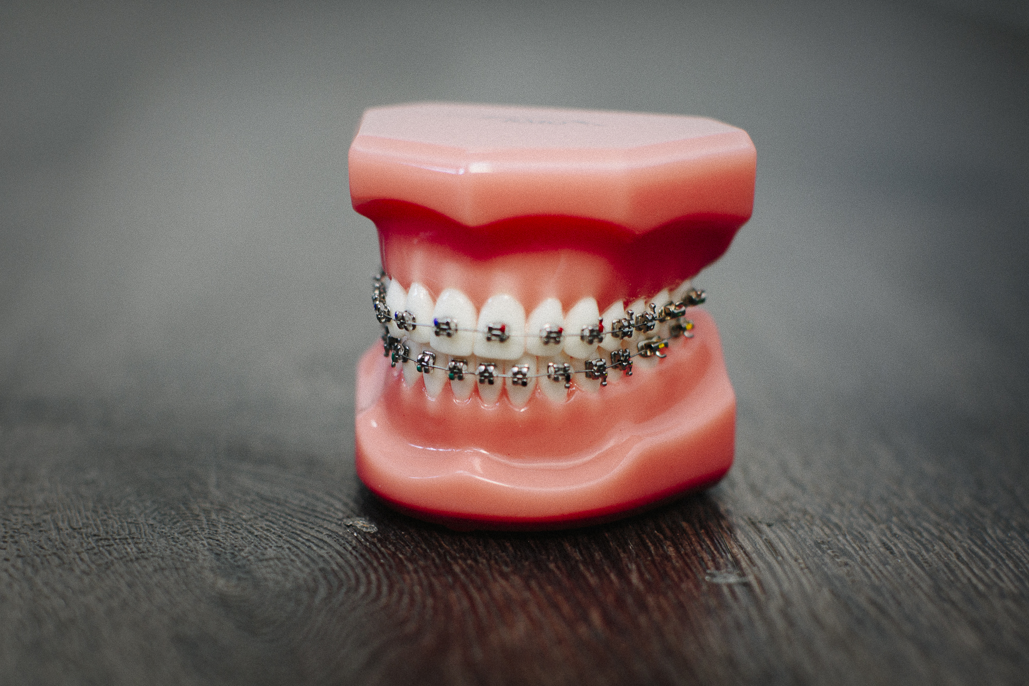 https://dental.harbors.in/wp-content/uploads/2023/06/Dental-Braces2.jpg