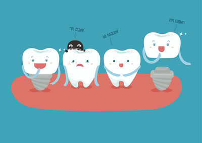 https://dental.harbors.in/wp-content/uploads/2023/06/Dental-Implant3.jpg