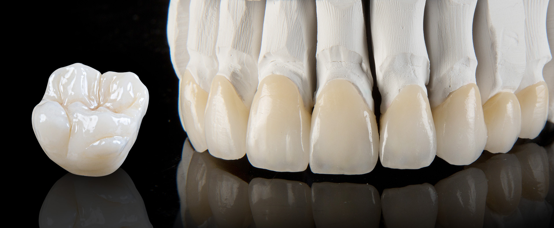 https://dental.harbors.in/wp-content/uploads/2023/06/DentalCrown3.jpg