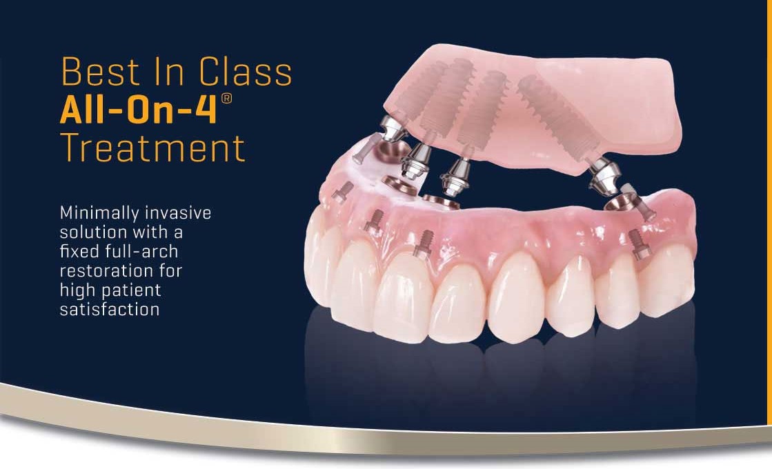 https://dental.harbors.in/wp-content/uploads/2023/06/Denture6.jpg