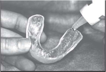 https://dental.harbors.in/wp-content/uploads/2023/06/preventive-dentistry4.jpg
