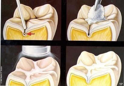 https://dental.harbors.in/wp-content/uploads/2023/06/preventive-dentistry5.jpg