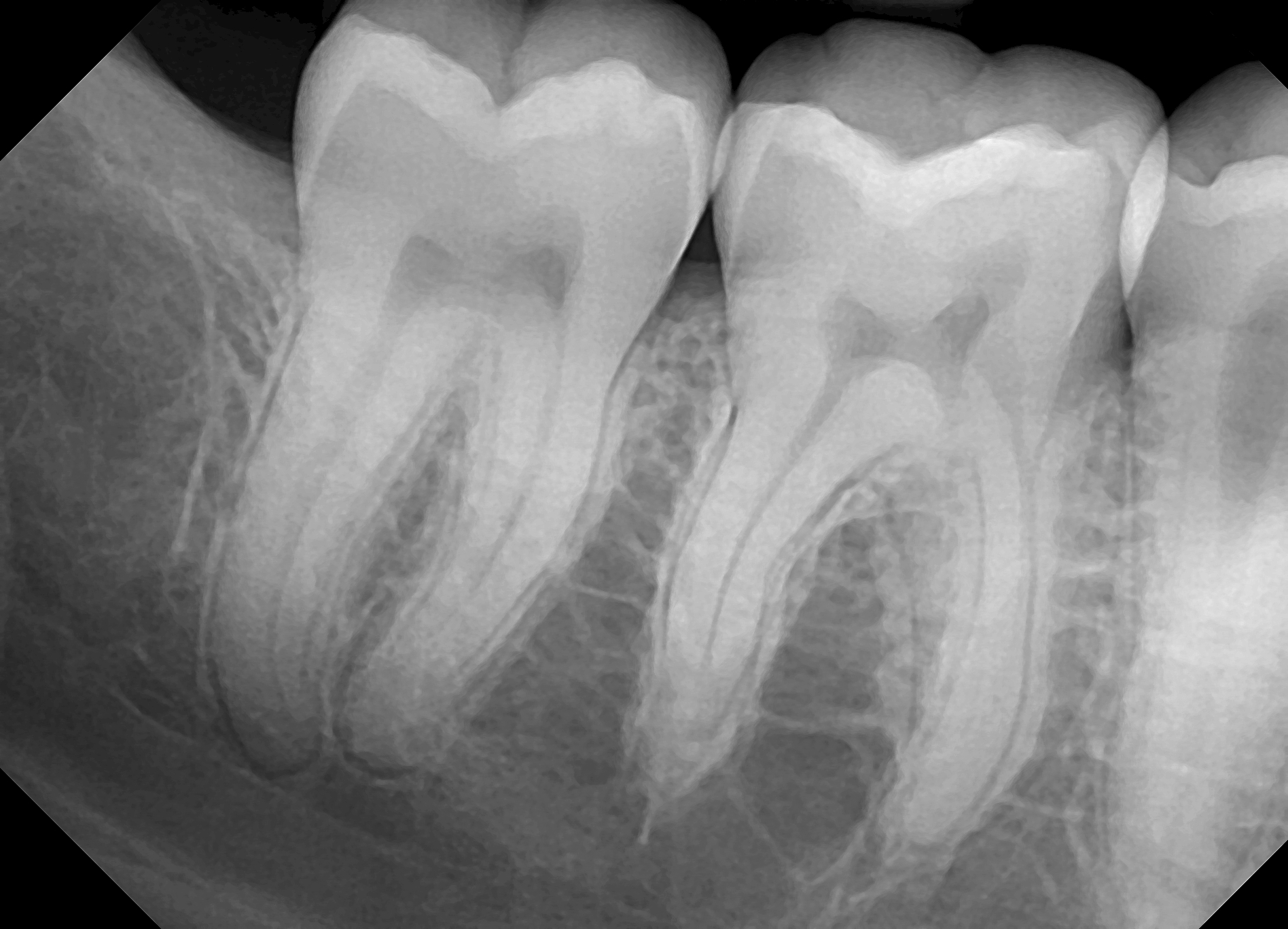 https://dental.harbors.in/wp-content/uploads/2023/06/xray1.jpg