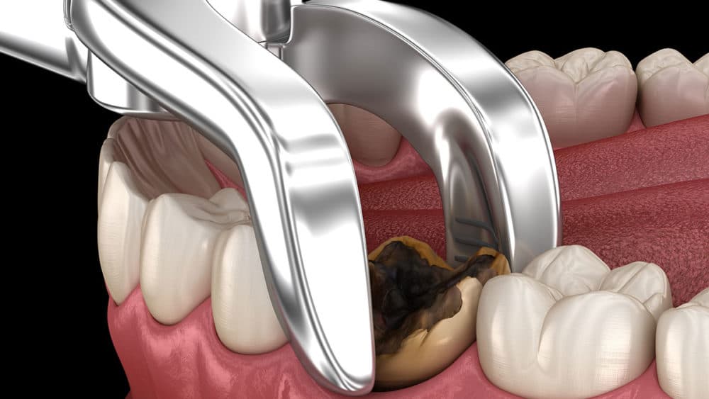 https://dental.harbors.in/wp-content/uploads/2023/07/9-dental-surgery.jpg