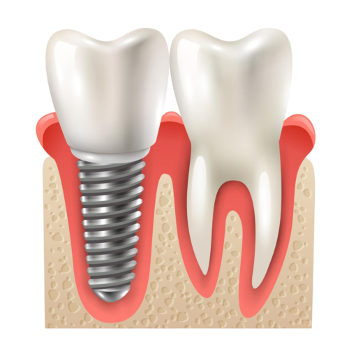 https://dental.harbors.in/wp-content/uploads/2024/01/15060_prev_ui.png