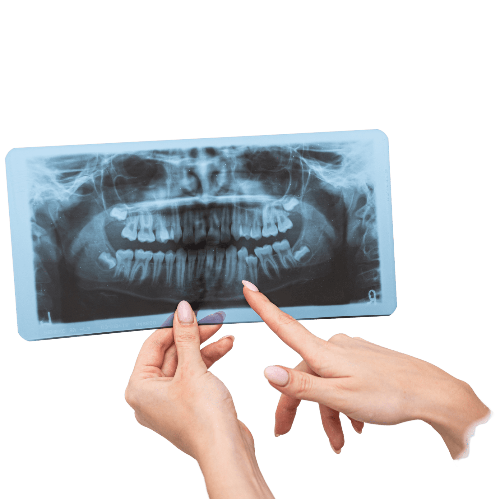 https://dental.harbors.in/wp-content/uploads/2024/01/Digital-xray.png