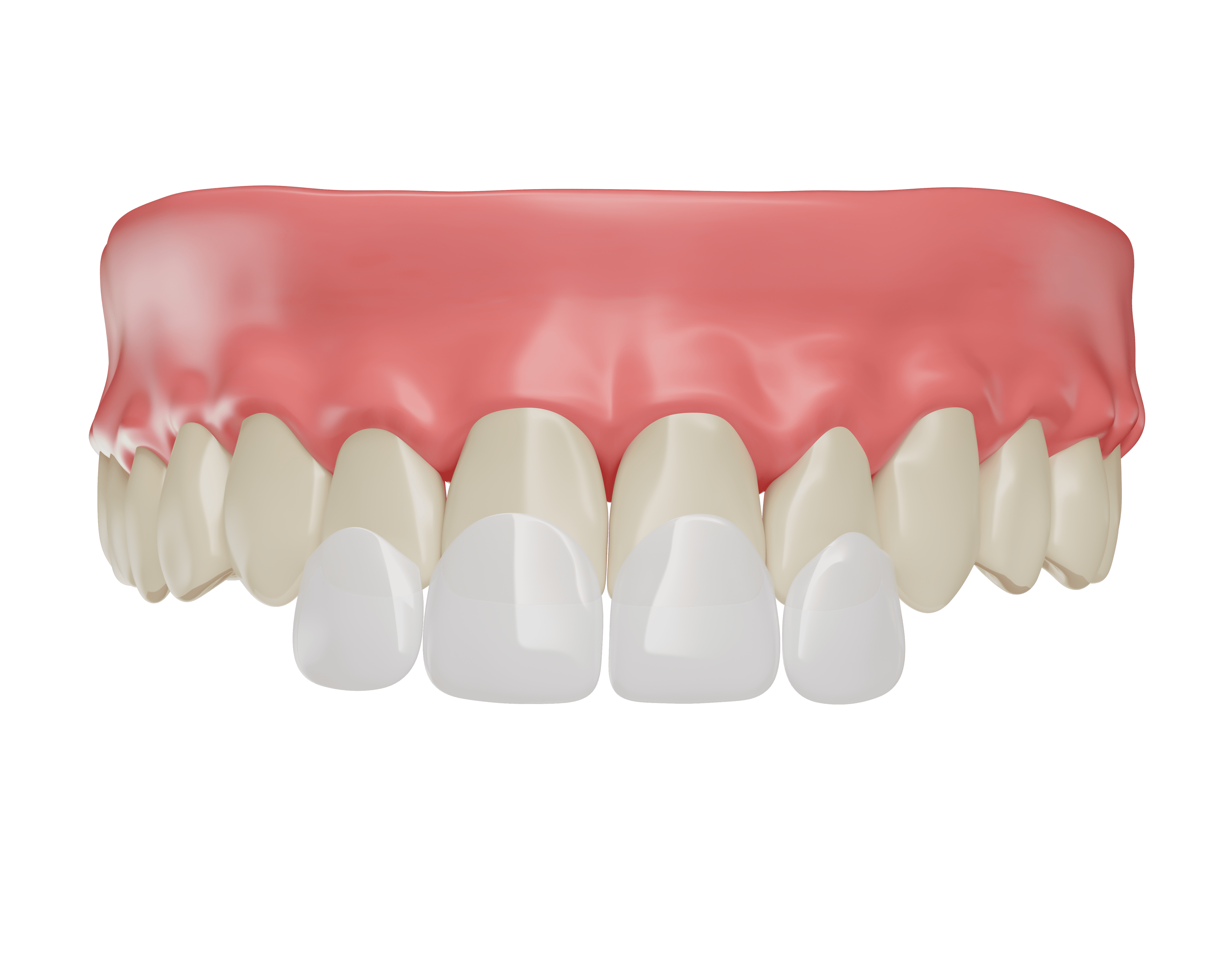 https://dental.harbors.in/wp-content/uploads/2024/01/Venners.png
