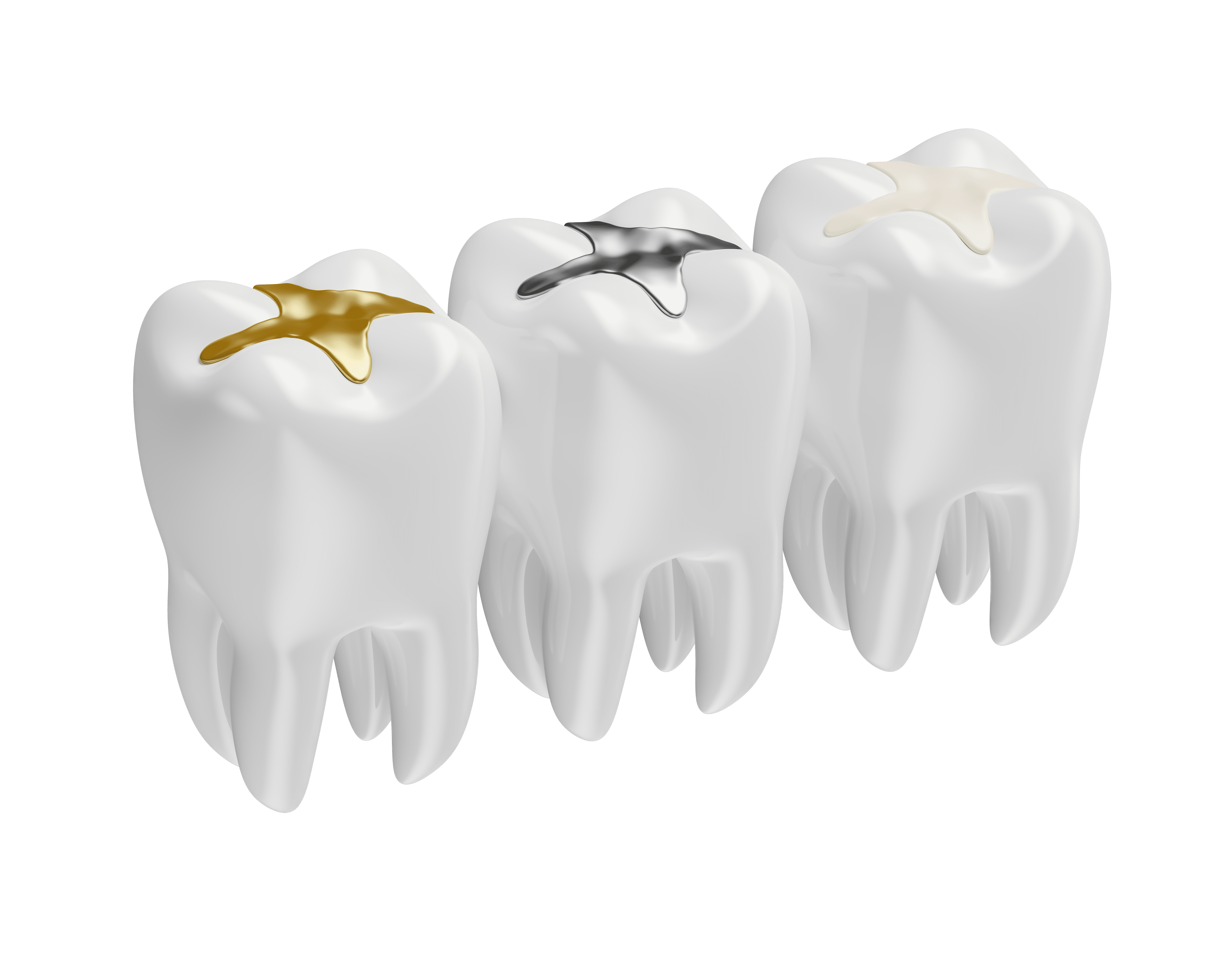 https://dental.harbors.in/wp-content/uploads/2024/01/tooth-color-filling.png